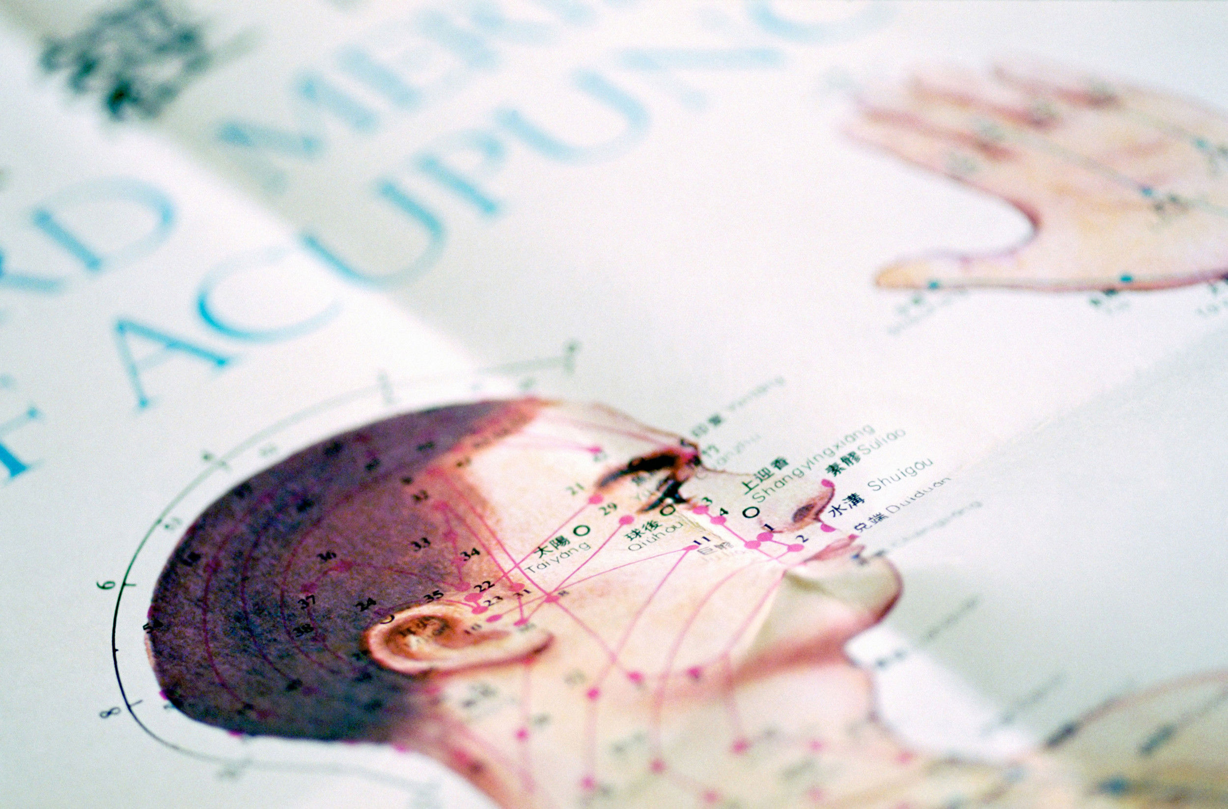 Picture of acupuncture points on the head.